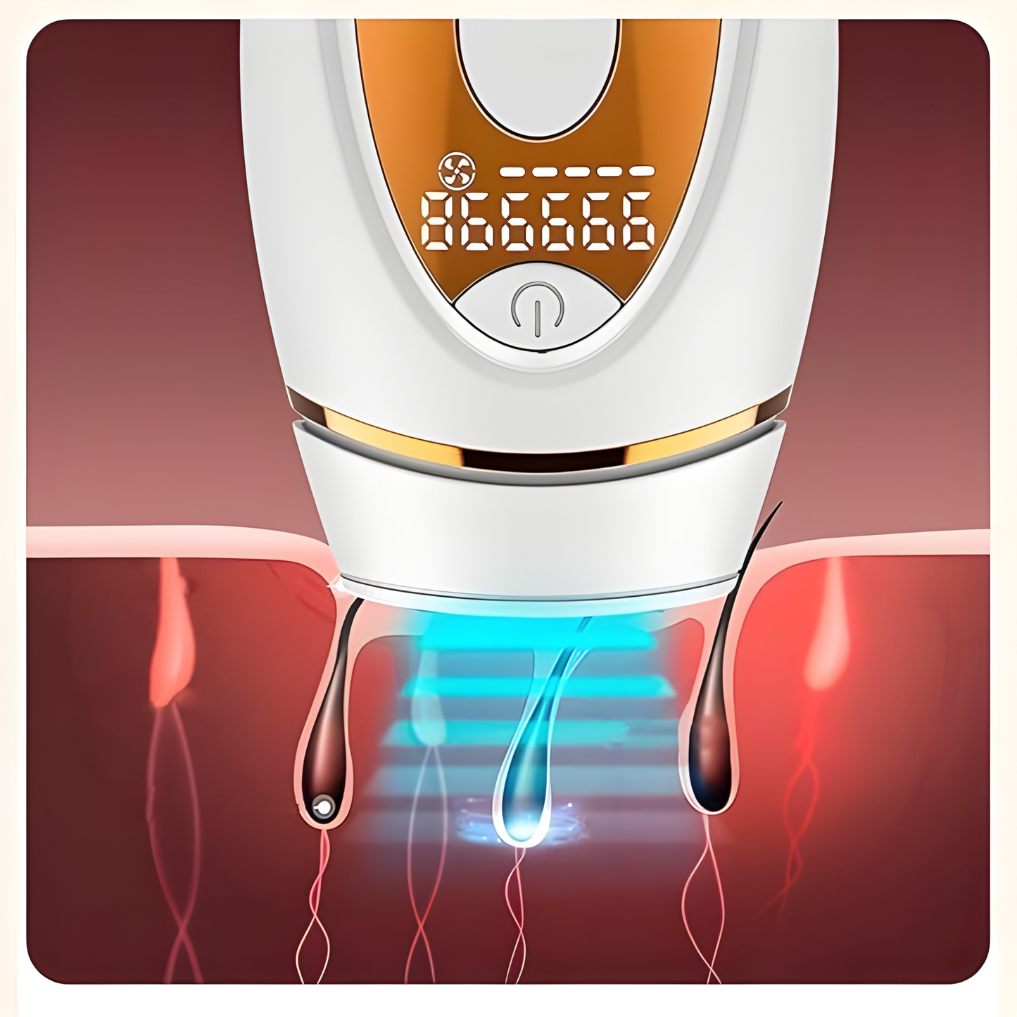 Emfizo™ - Hair Remover